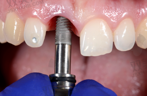 【北京维恩口腔房山店怎么样】