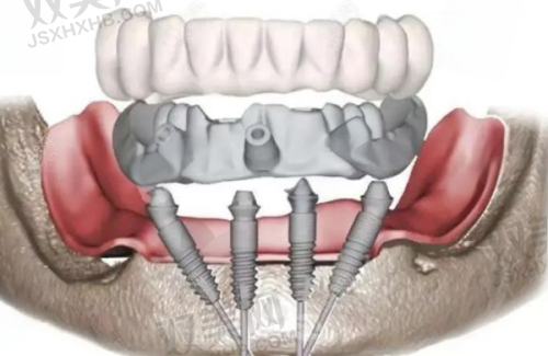 【北京维恩口腔五道口店技术特点】