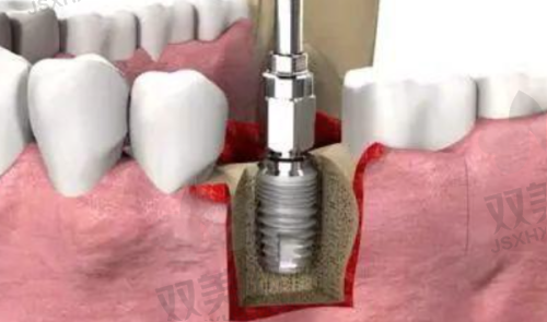 【北京通州雅仕口腔门诊部电话号码是多少】