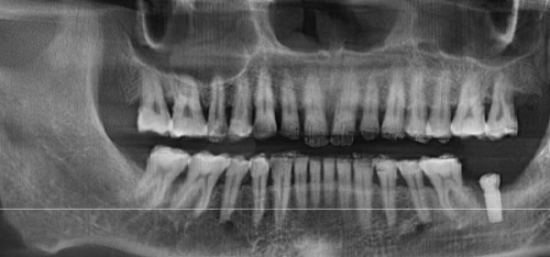 【北京通州雅仕口腔门诊部擅长什么项目】