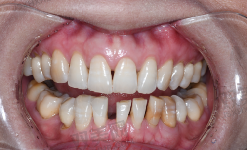 【北京维恩口腔常营店怎么预约挂号】