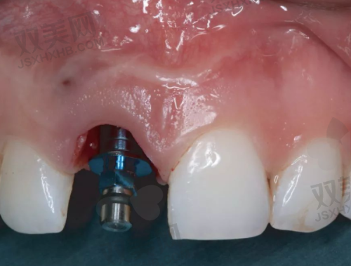 【北京通州雅仕口腔门诊部地址及乘车路线】