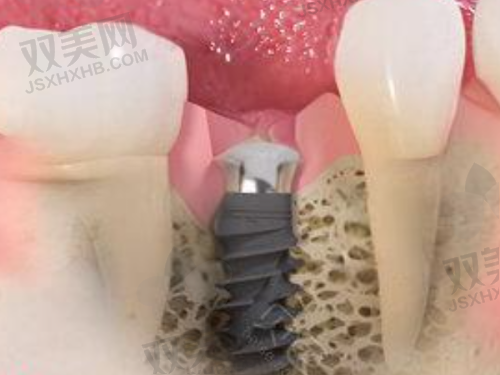 【北京维恩口腔房山店技术特点】