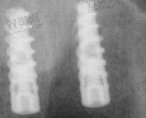 【北京瑞鲨口腔医院擅长什么项目】