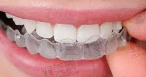 金属托槽矫正费用