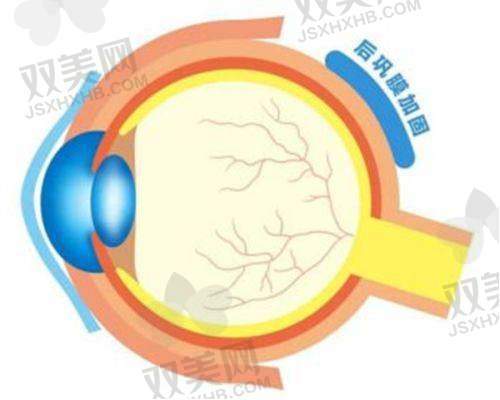 定期进行眼部检查