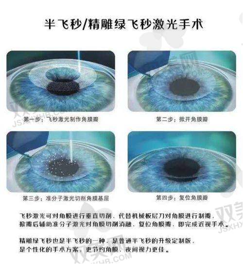 术后护理差异:全飞秒和半飞秒的注意事项