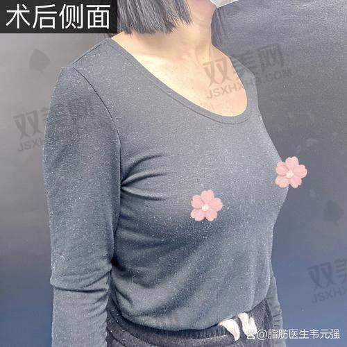 傲诺拉闪耀隆胸的手感体验