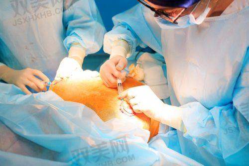 傲诺拉隆胸后的护理要点