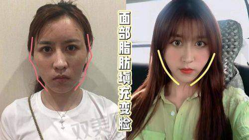 陈再洪医生口碑