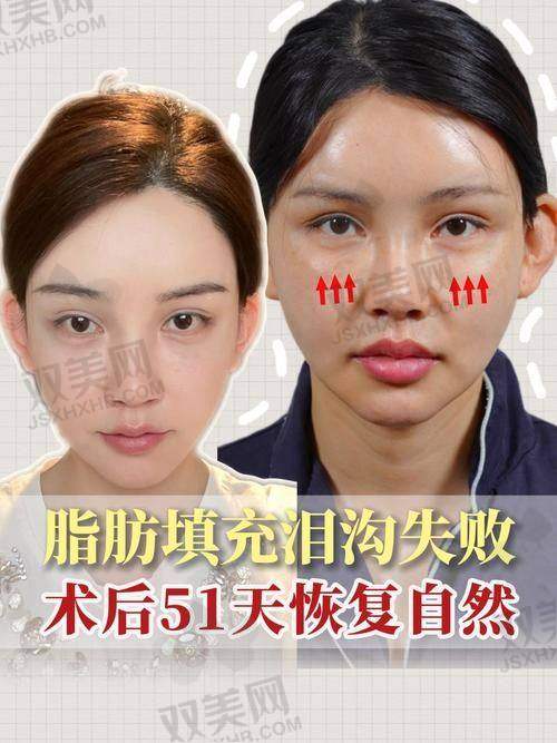 成都新丽美医院优势