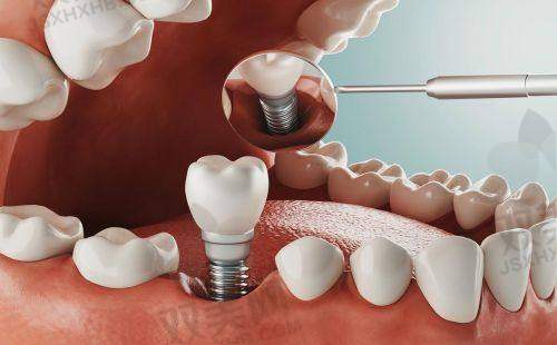 【北京维恩口腔安贞和平总院营业时间是什么时候】