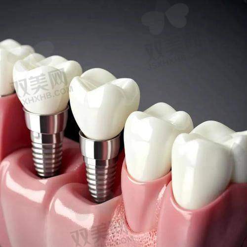 北京劲松苏州桥口腔医院技术特点