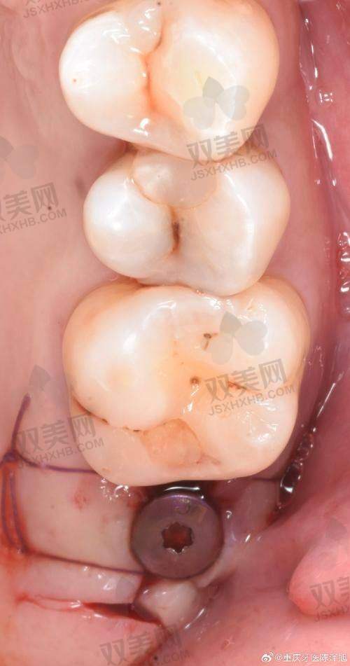 【北京维恩口腔房山店是正规的吗】