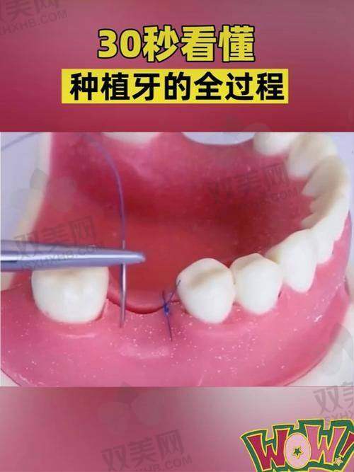 【北京维恩口腔五道口店怎么样】