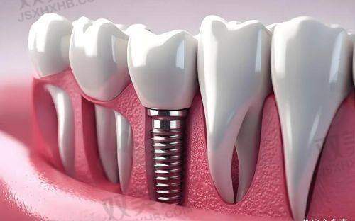 【北京维恩口腔亦庄店怎么预约挂号】