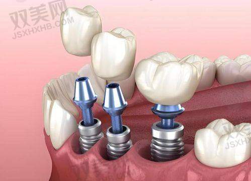 【北京瑞鲨口腔医院是私立还是公办】