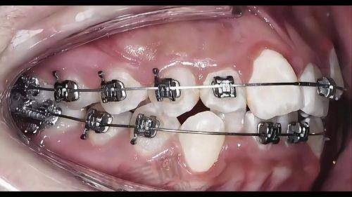 【北京京一口腔门诊部是正规的吗】