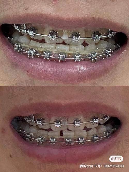 【北京倪氏口腔医院地址及乘车路线】