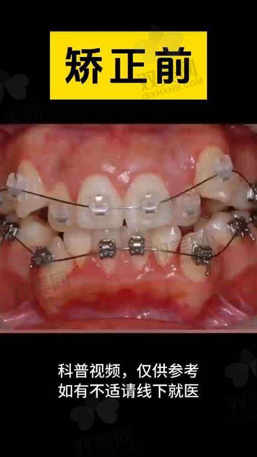 片切的弊端是什么？