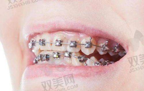 从预算角度判断