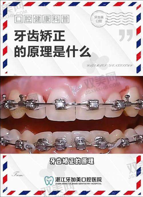 如何选择适合自己的金属托槽