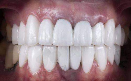 【北京昌平牙适乐口腔门诊部怎么样】