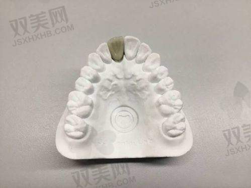 【北京京通口腔门诊部擅长什么项目】