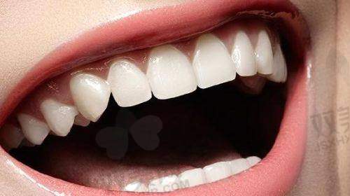 【北京瑞鲨口腔医院怎么预约挂号】