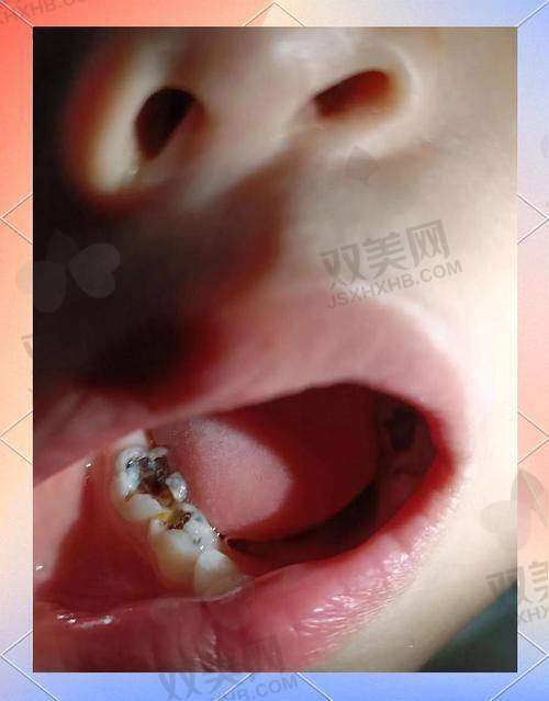 【北京京通口腔门诊部技术特点】