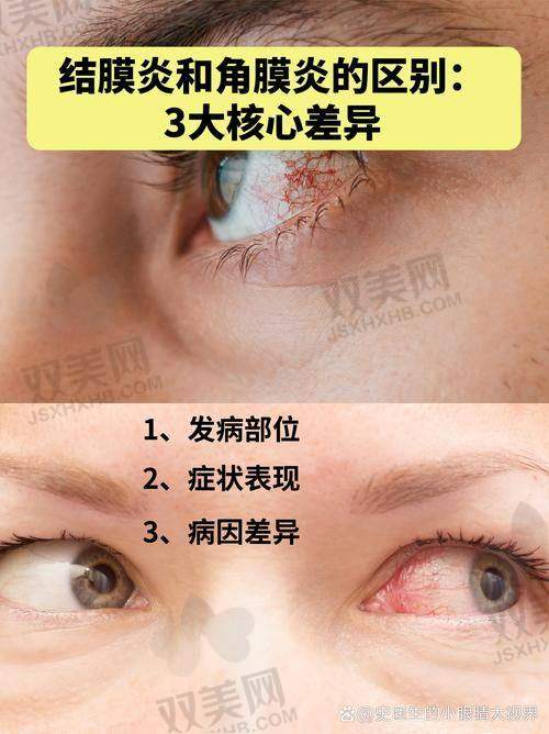 【包头市中 心医院眼科怎么样】