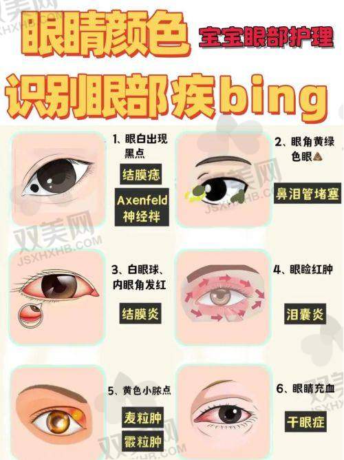 【包头医学校第一附属医院眼科擅长什么项目】