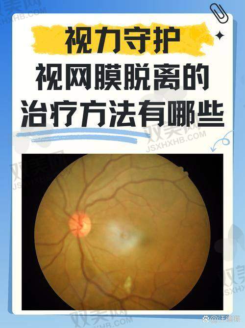 【内蒙古朝聚眼科医院技术特点】