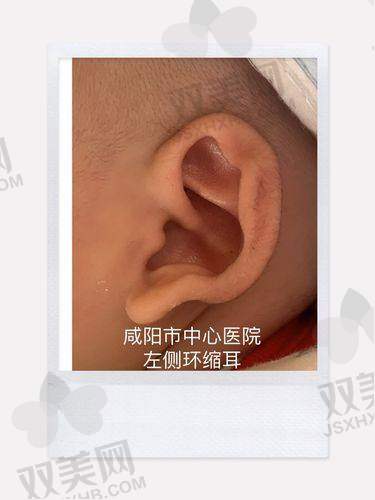 三、成都新丽美医院优势