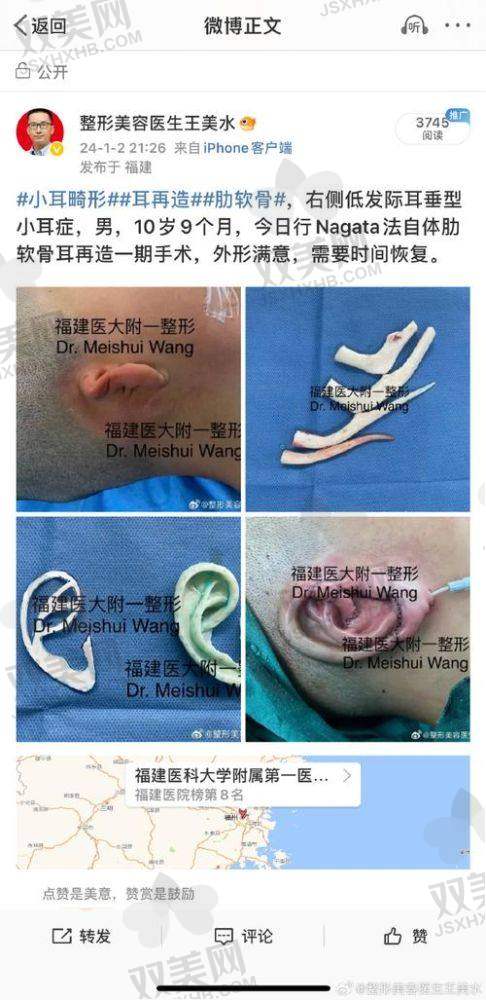 六、成都新丽美陈再洪医生做耳屏畸形矫正术(先天性缺如)的预约挂号方式