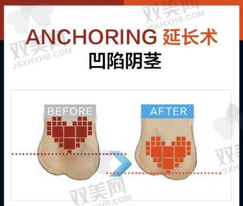 【茂名盛熙医疗美容诊所是私立还是公办】