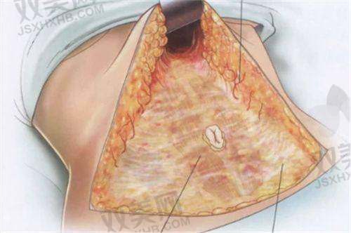 【茂名盛熙医疗美容诊所地址及乘车路线】