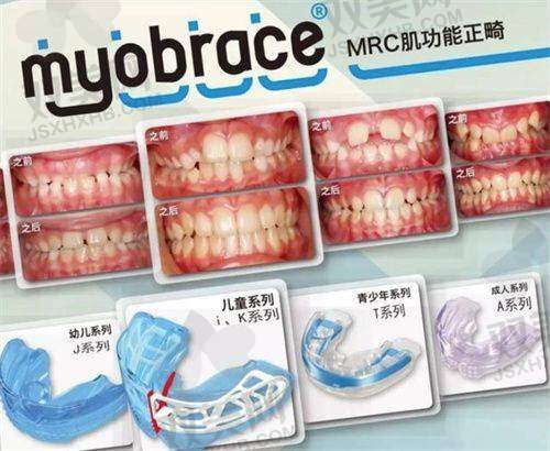 【北京圣贝口腔医院怎么预约挂号】