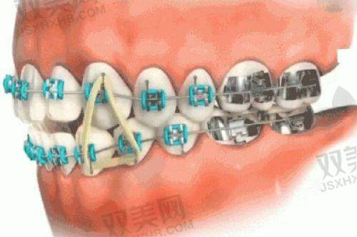 【北京顺义瑞和口腔门诊部怎么样】