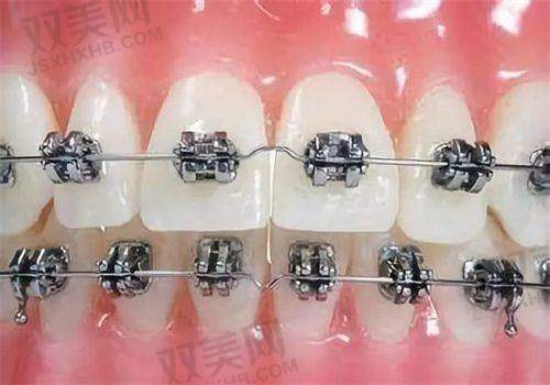 【北京东直门齿美口腔门诊部是正规的吗】