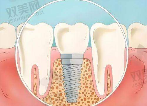 【北京房山京都惠美口腔诊所擅长什么项目】