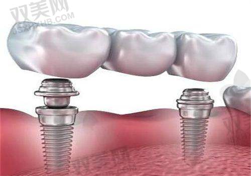 【北京有来口腔门诊门诊部营业时间是什么时候】