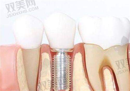 【北京诺贝加尔口腔门诊部医生名单】