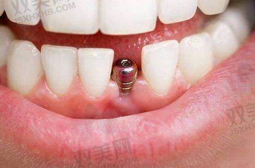 【北京密云健福口腔门诊部怎么预约挂号】