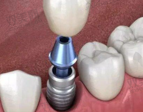 【北京微贝.芽美口腔门诊部电话号码是多少】