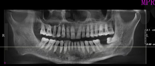 【北京微贝.芽美口腔门诊部怎么预约挂号】