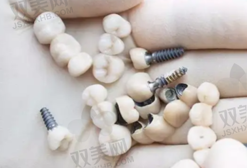 【北京圣贝口腔医院怎么样】