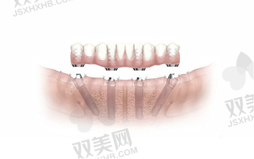 【北京有来口腔门诊门诊部怎么样】