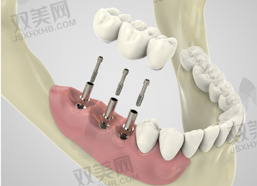 【北京有来口腔门诊门诊部是正规的吗】