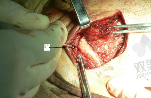 【北京诺贝加尔口腔门诊部电话号码是多少】